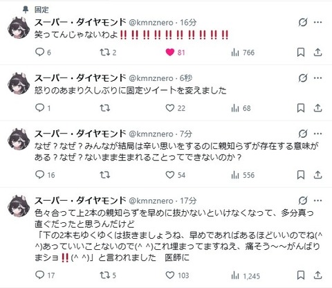 【KMNZ】ネロ「下の親知らず2本とも完全に横向きで埋まっていて…」← 一番アカンタイプのやつやん | 【KMNZ】ネロ「下の親知らず2本とも完全に横向きで埋まっていて…」← 一番アカンタイプのやつやん | VTuberまとめ速報 V速(画像11180916151920_2)