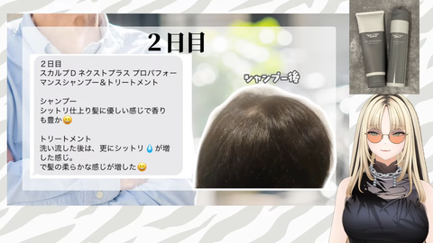 【ホロライブ】ニコ父の頭皮が配信デビュー、スカルプDをガチレビュー！ | 【ホロライブ】ニコ父の頭皮が配信デビュー、スカルプDをガチレビュー！ | 【ホロライブ】ニコ父の頭皮が配信デビュー、スカルプDをガチレビュー！ | 【ホロライブ】ニコ父の頭皮が配信デビュー、スカルプDをガチレビュー！ | 【ホロライブ】ニコ父の頭皮が配信デビュー、スカルプDをガチレビュー！ | VTuberまとめ速報 V速(16142114862311_5)
